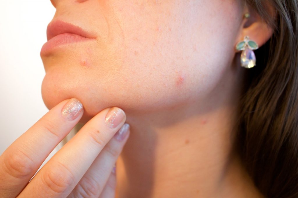 Skin Infection | Arthritis | Long Term solution
